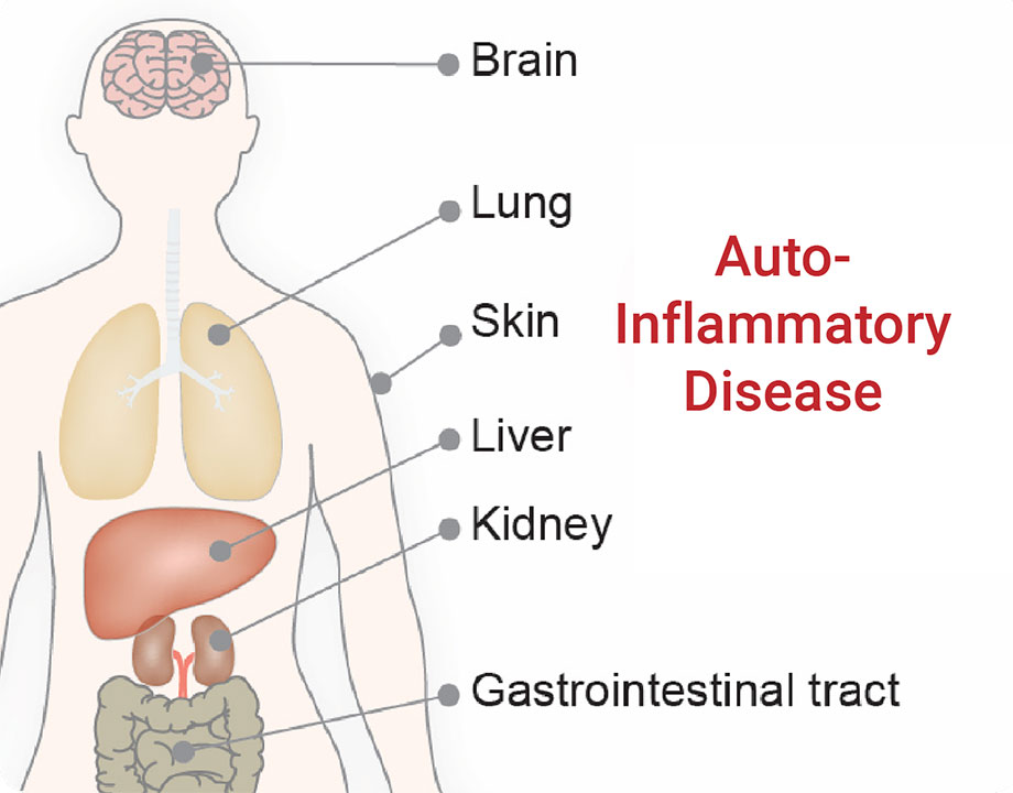 Auto Inflammatory Disease - diagram